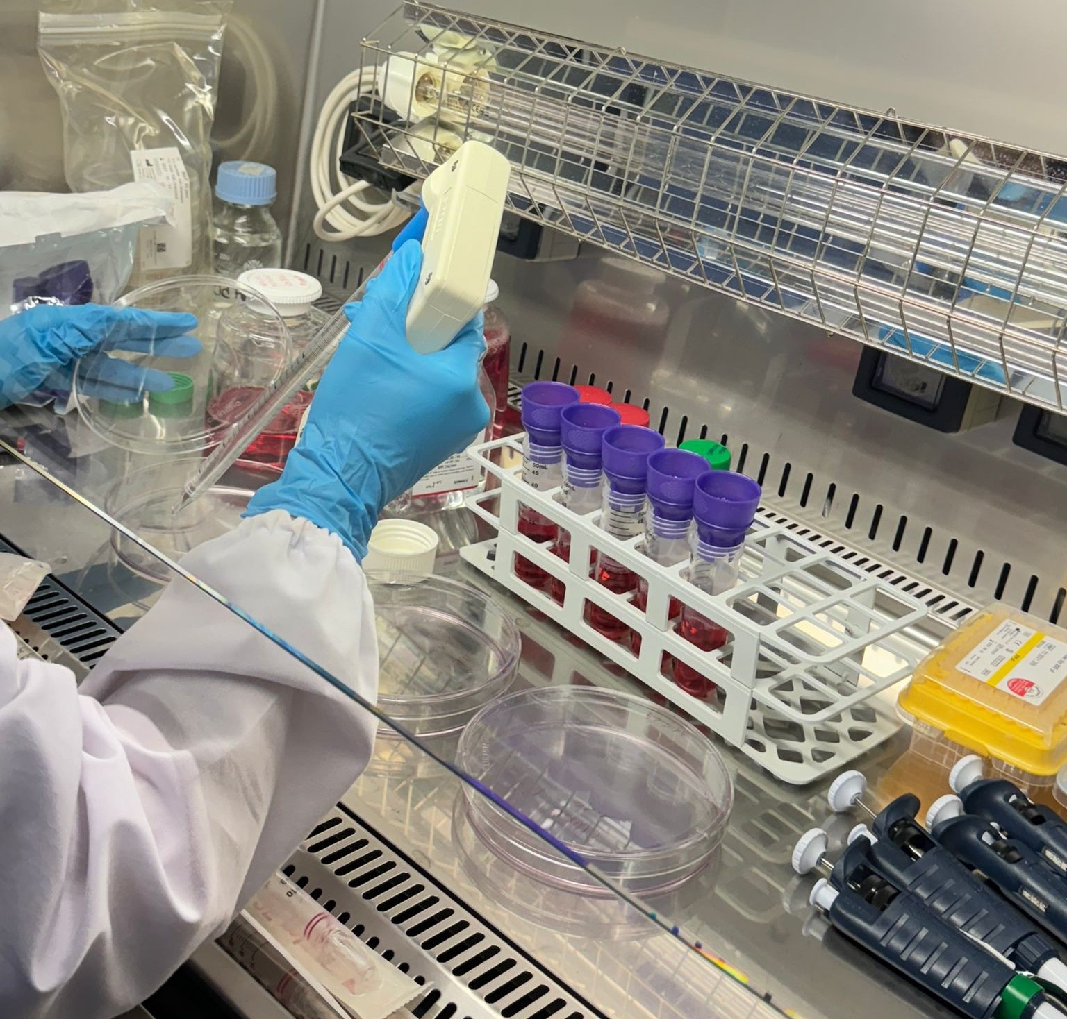 A Biogem-Vanvitelli joint study identifies a new suppressor of hepatocellular carcinoma